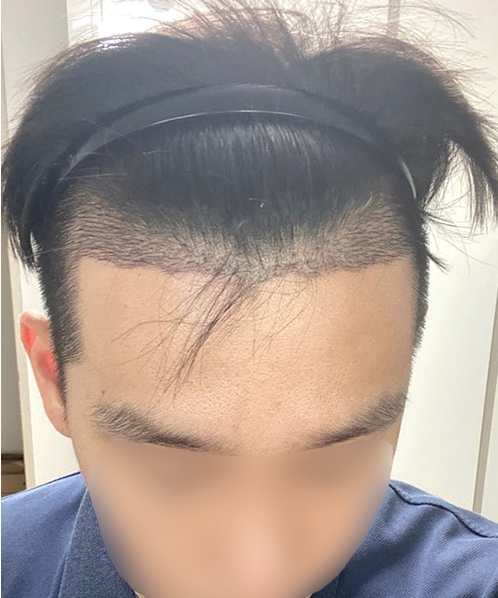 후3.PNG