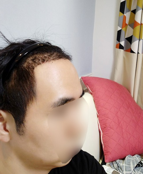 후1.PNG