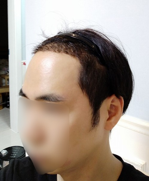 후2.PNG