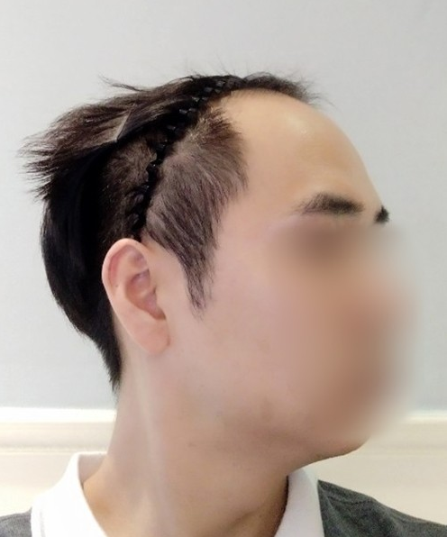 수술전