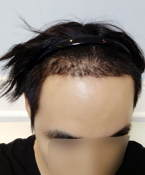 후3.PNG