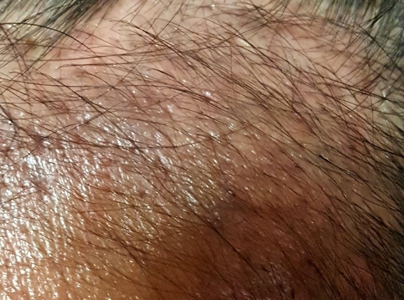 20170604_205417.jpg