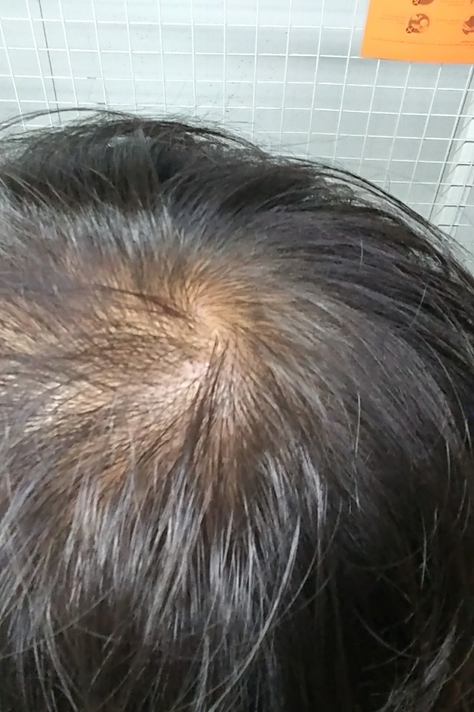 20170713_104932-1.jpg