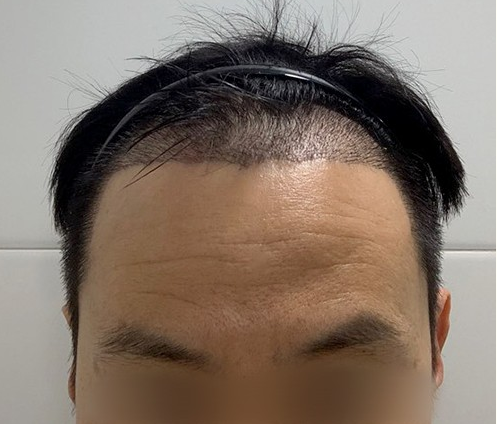 20200722 후 3.PNG