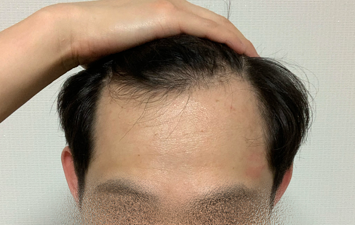 20200701 전 1.PNG