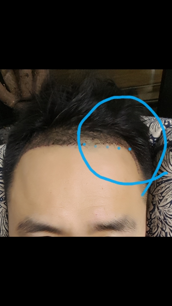 Screenshot_20180307-223419.png