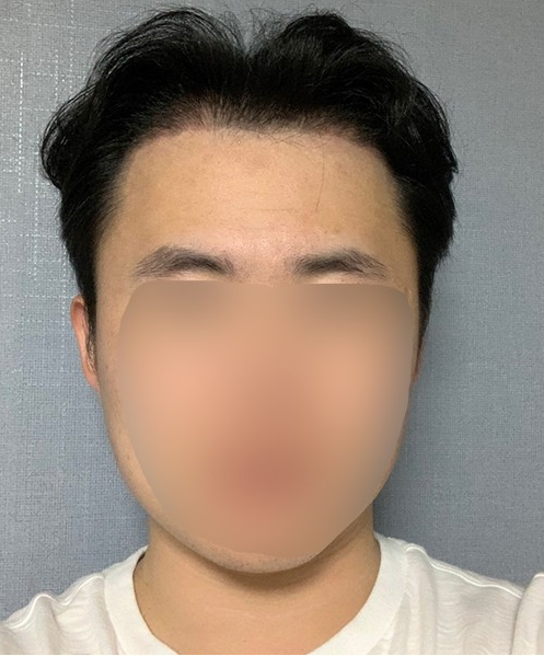 후3.PNG
