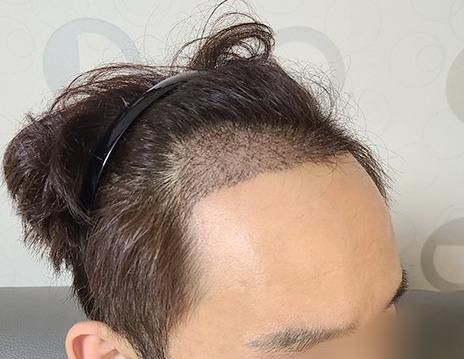 20200721 후 2.PNG