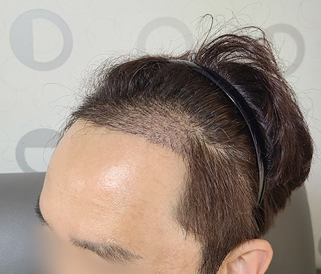 20200721 후 1.PNG