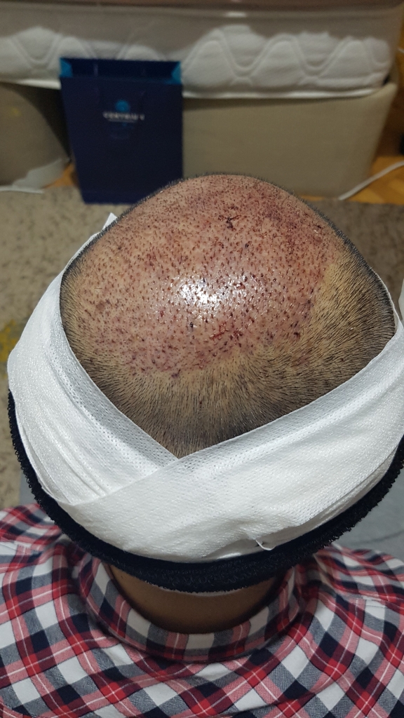 20181219_214230.jpg
