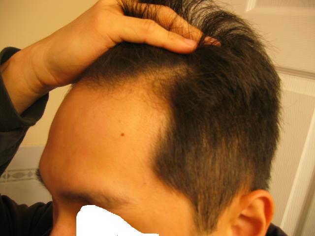 Side3.JPG