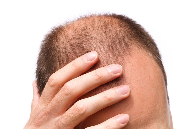 iStock_000011594336Small.jpg