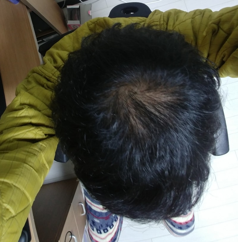 20181205_225917~2.jpg