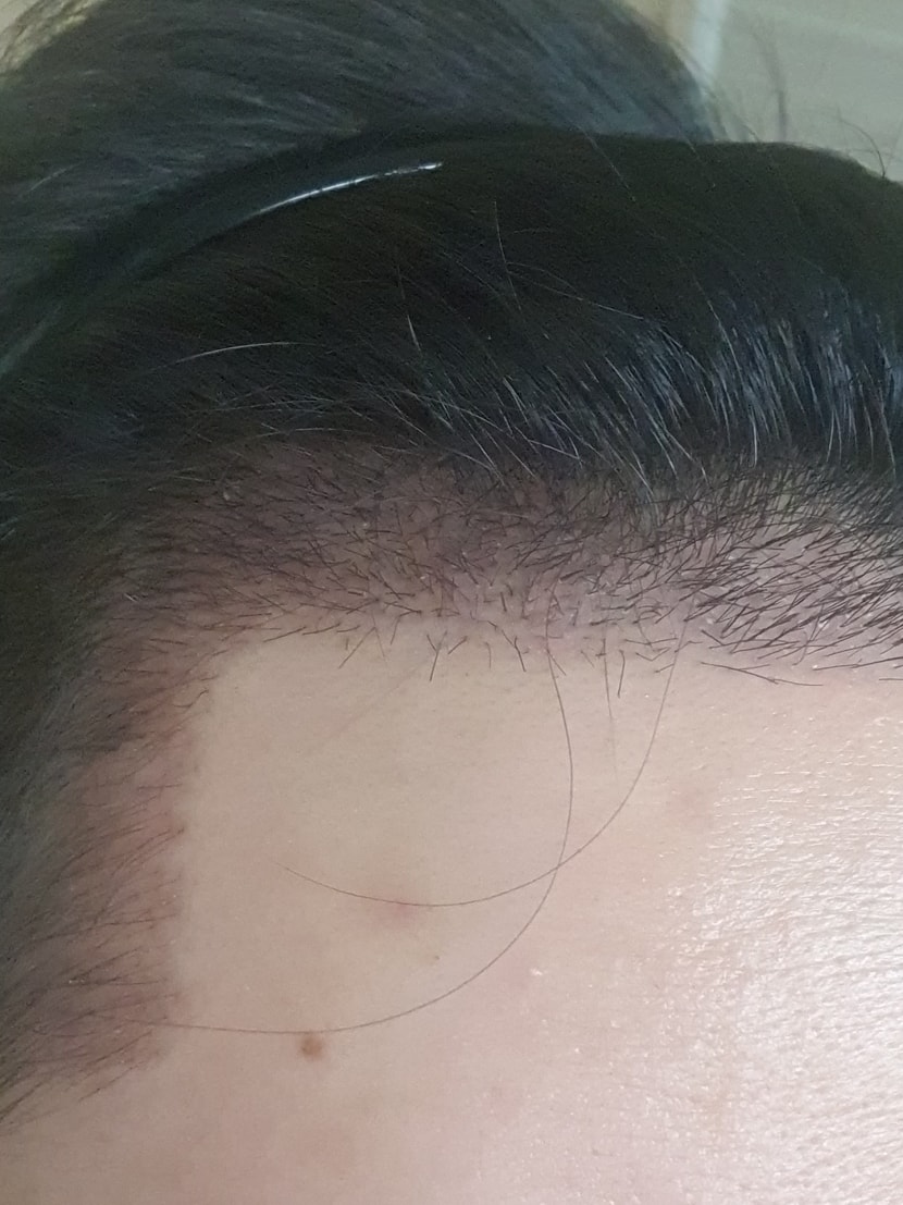 옆면