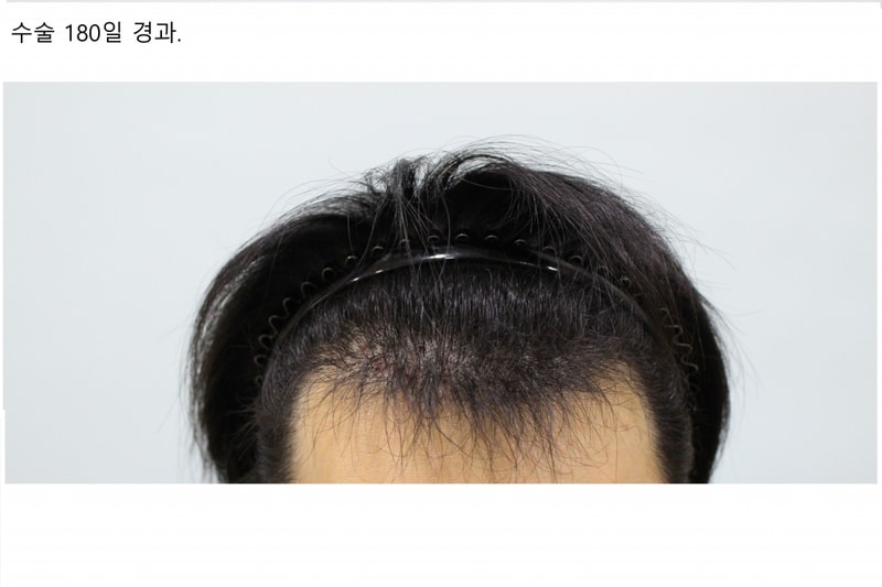 머리1.jpg