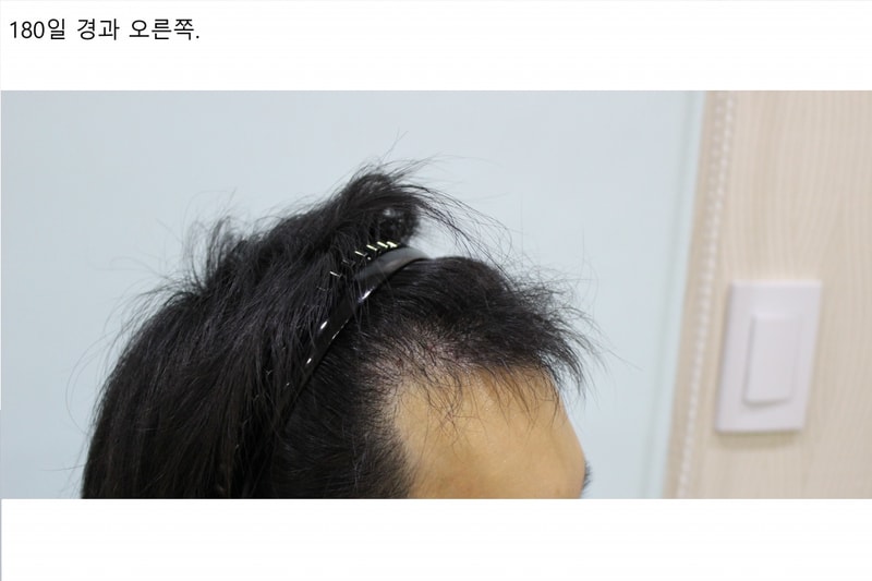 머리 오른쪽.jpg