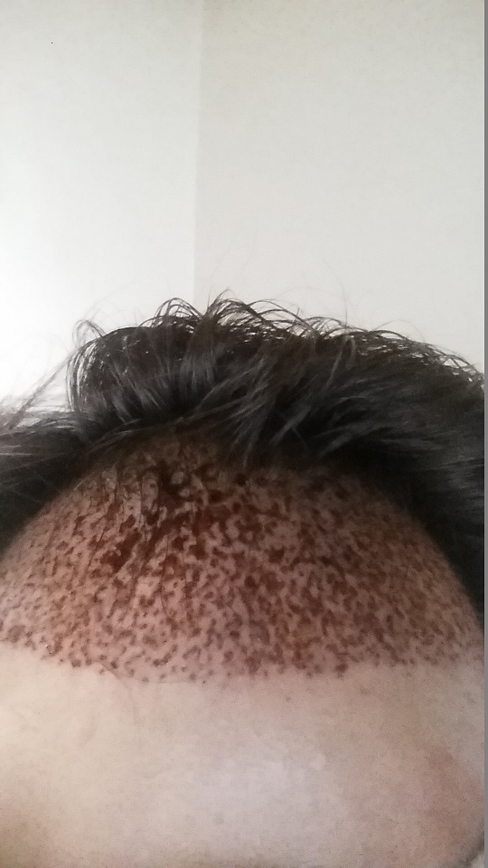 처음.jpg