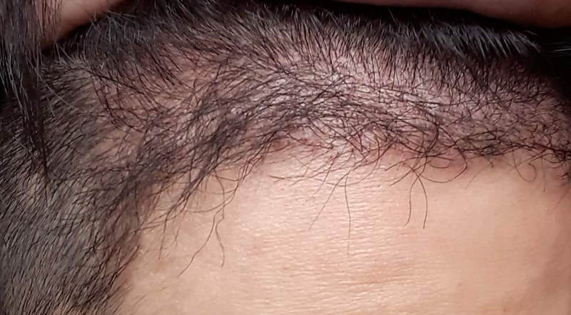 4개월 12.jpg