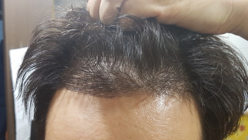 KakaoTalk_20180309_135536980.jpg
