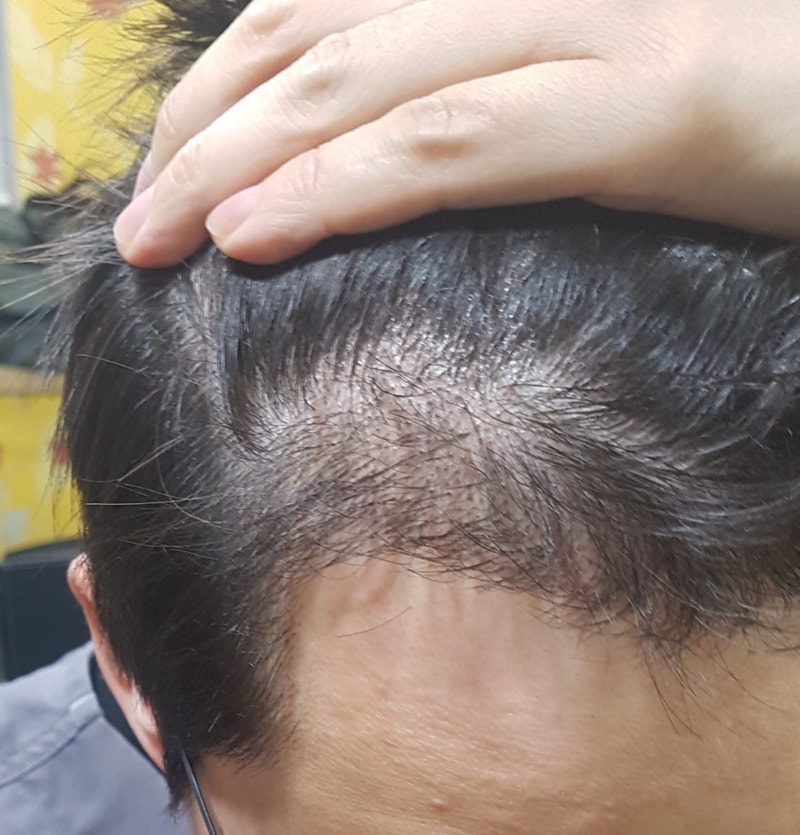 KakaoTalk_20180309_135535631.jpg