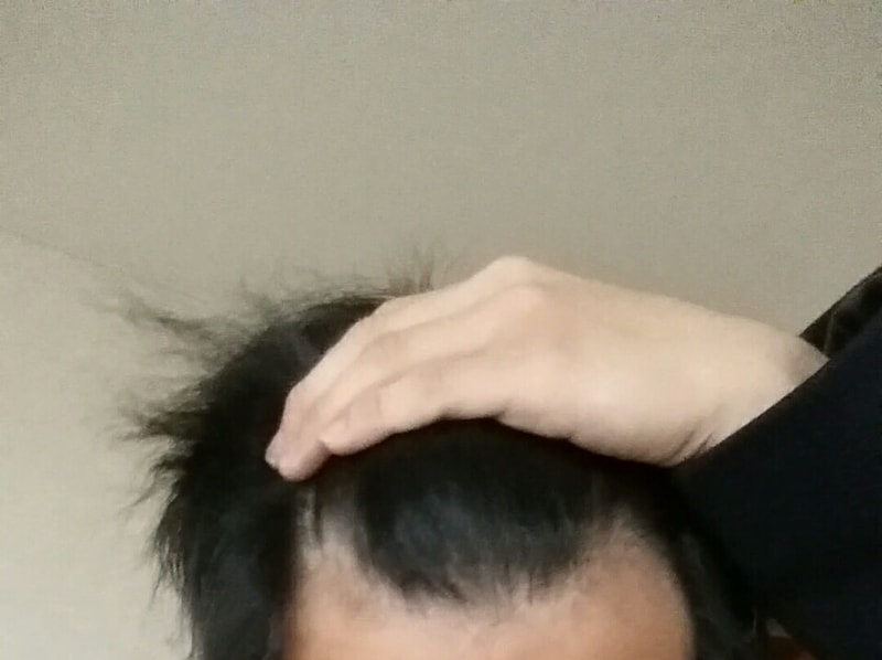 1489545490450.jpg