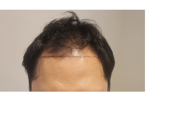 이마1.png