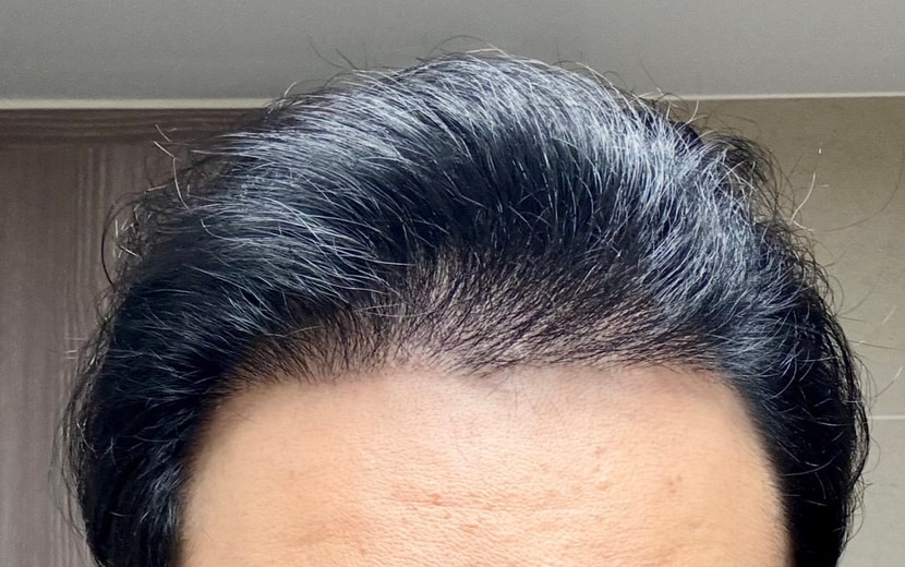 7개월차 현재