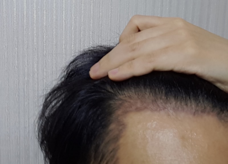 좌.png