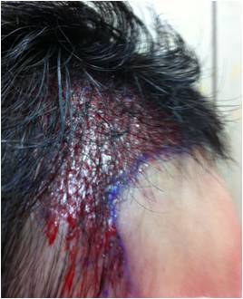 after-lateral.jpg