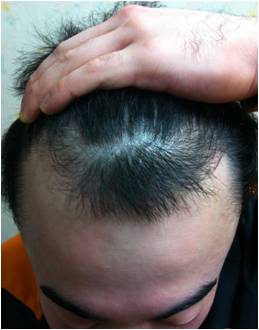 before.jpg