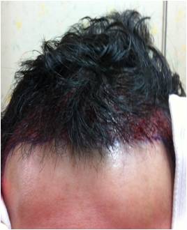 after-frontal.jpg