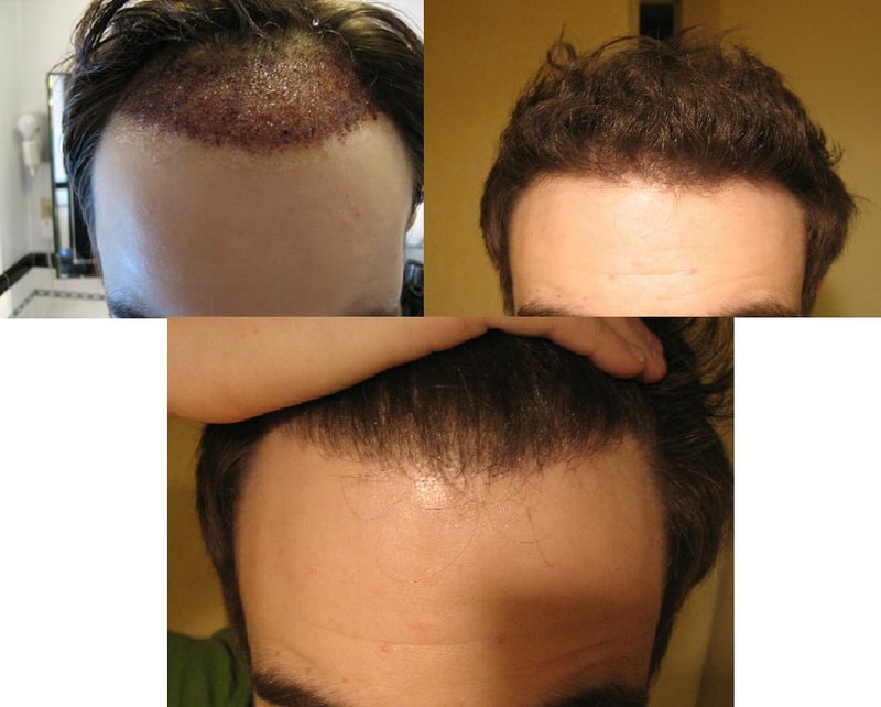 post 7 months.JPG