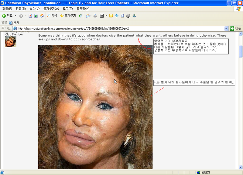멀쩡한 애 2700모낭16.png