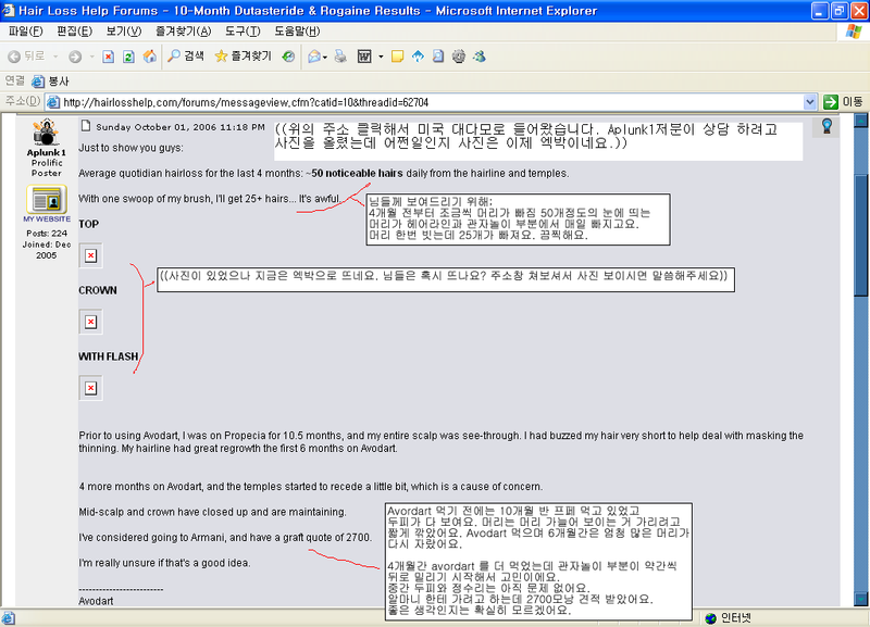 멀쩡한 애 2700모낭1.png