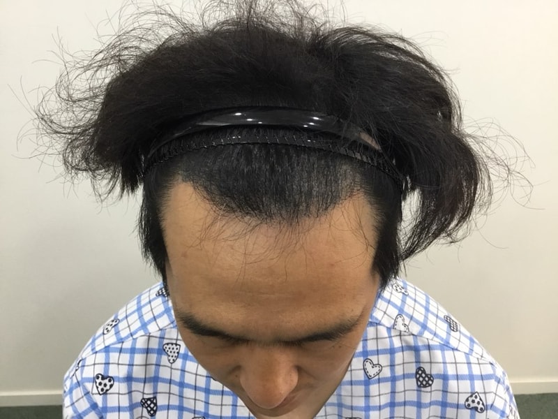 9월 18일 수술 전.jpg