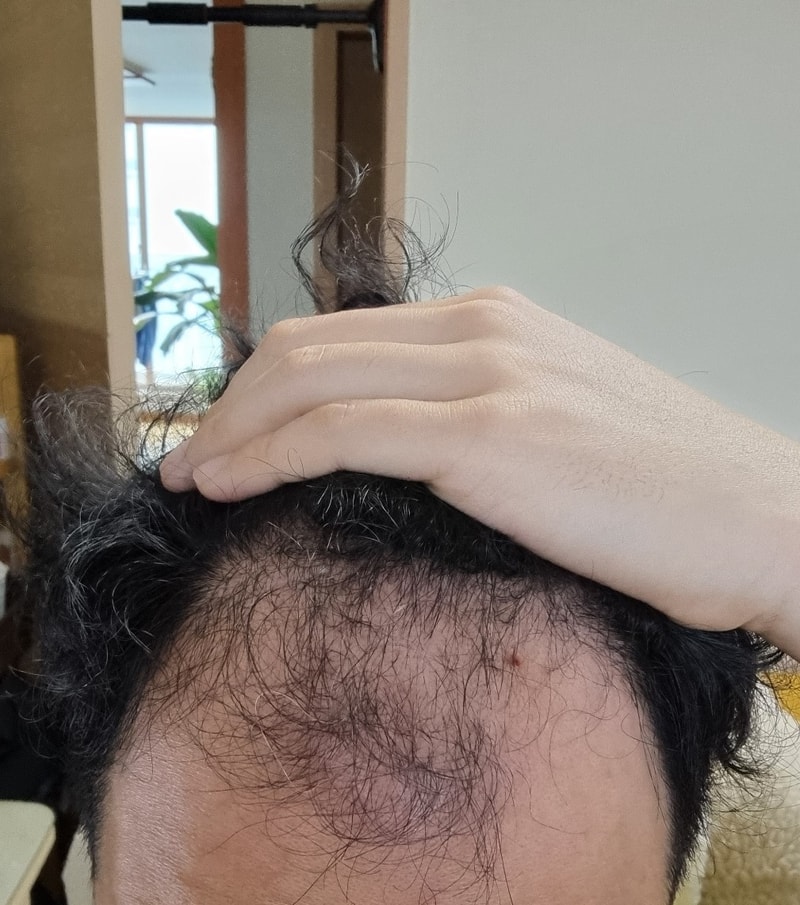이식전.jpg