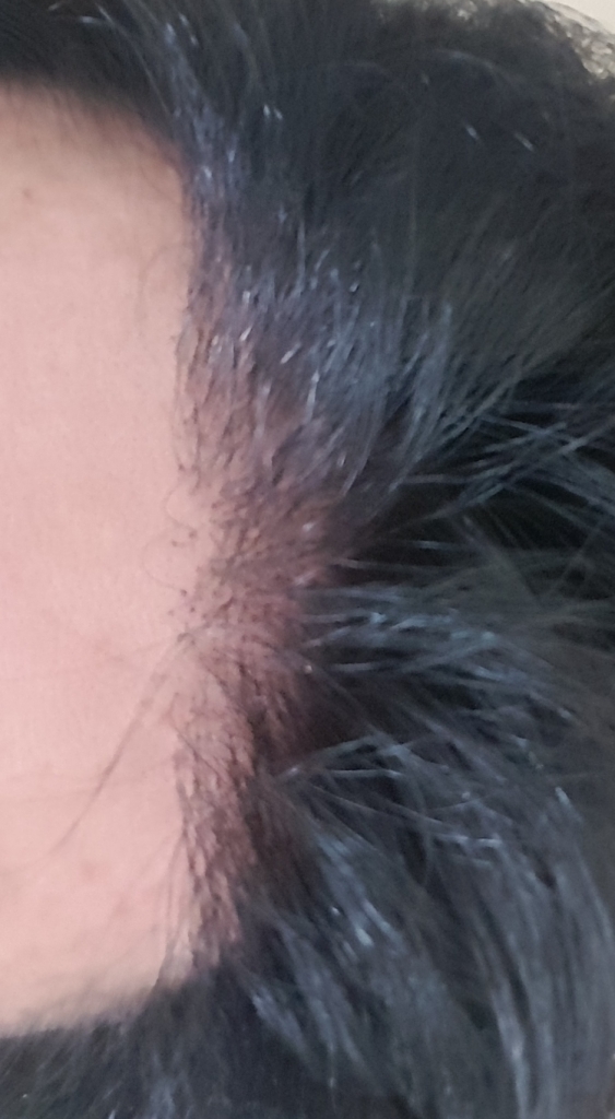 20180503_212619.jpg
