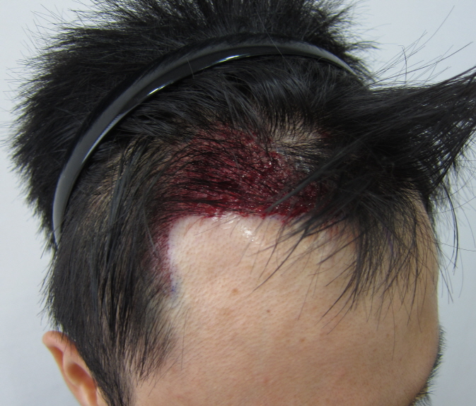 수술후2.JPG