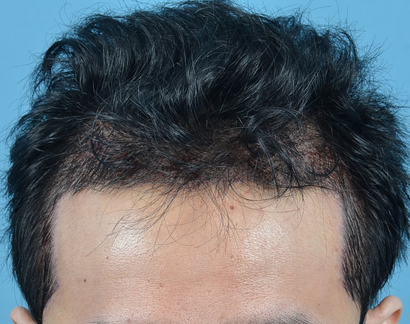 수술 다음날1.jpg