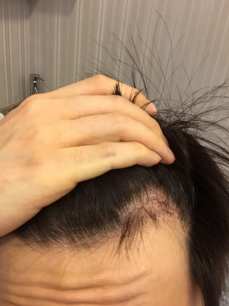 KakaoTalk_20170118_204341249.jpg