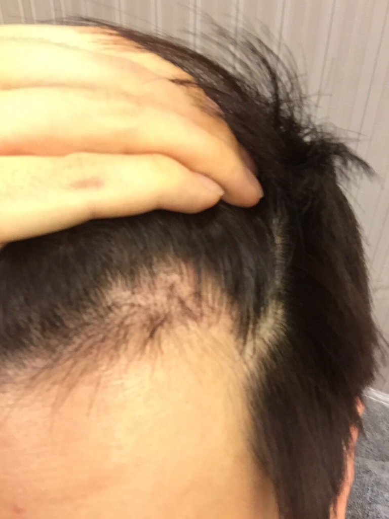 KakaoTalk_20170118_204443962.jpg