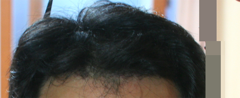 32th_day_front.jpg