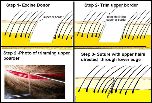 tricho-diagram.gif