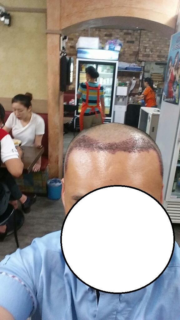 머리정면.jpg