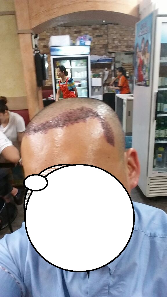 머리좌위.jpg