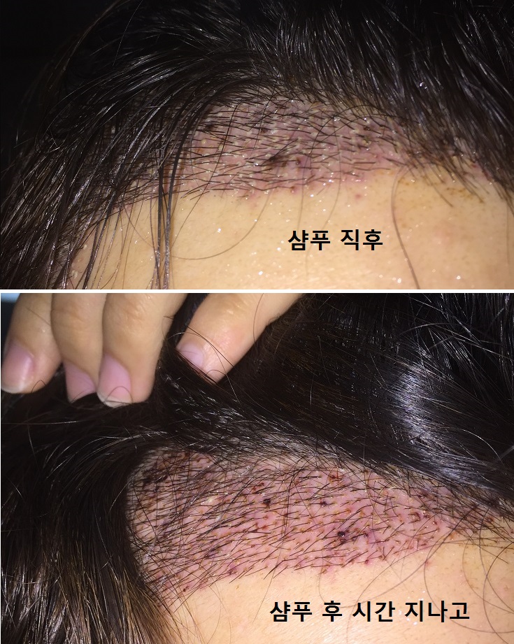 160529 샴푸후.jpg
