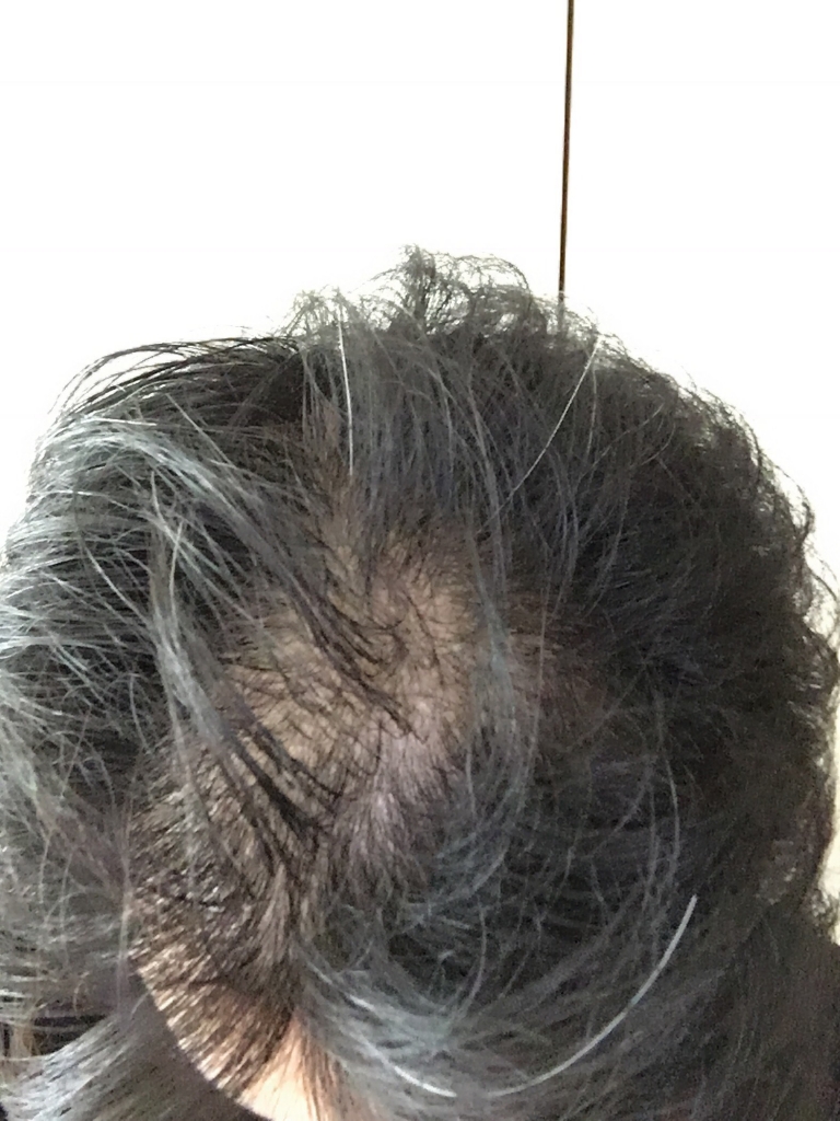 1E2838AD-F6A0-490C-A8C4-A701288976E9.jpeg