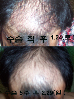 수술_후_사진.jpg