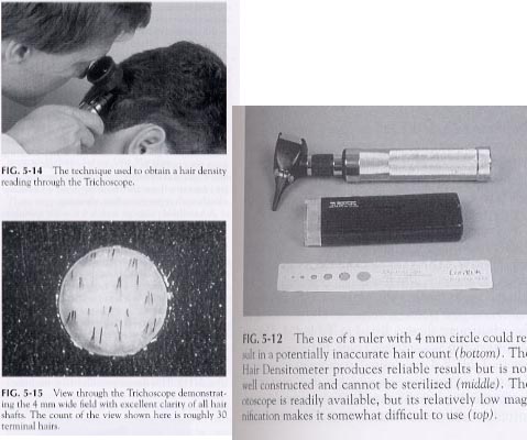 hair_densitometer.jpg