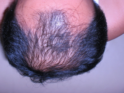 D_1_up.JPG